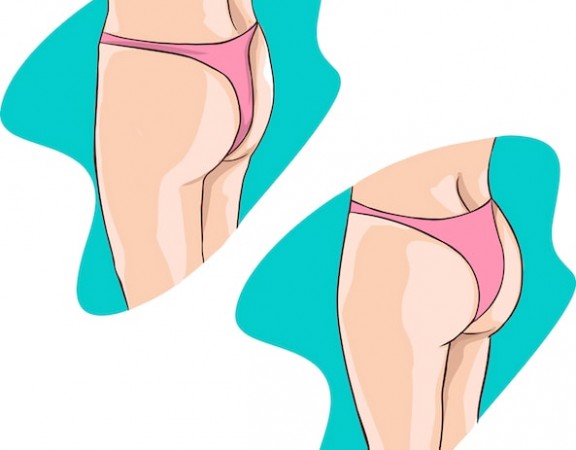 Types of Butt Implants