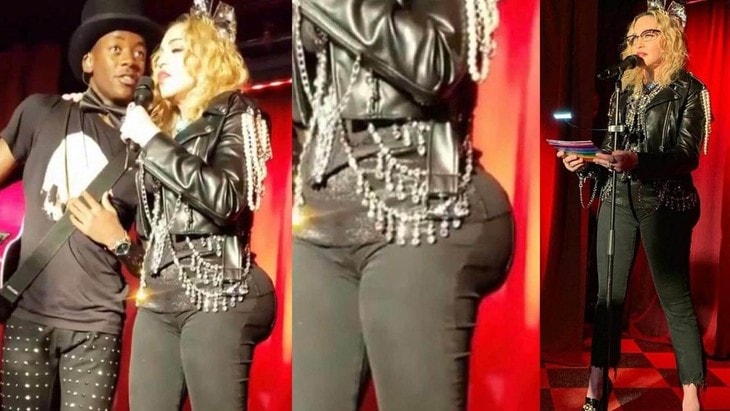 Madonna Butt Augmentation procedure